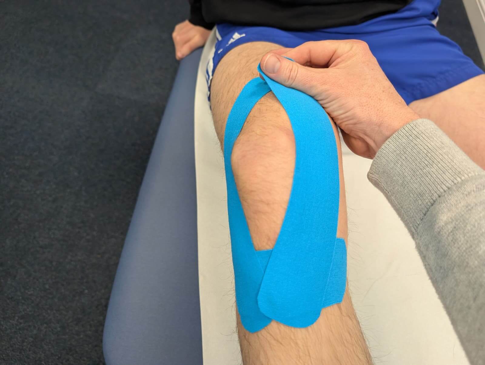 Physio Common Conditions Patellofemoral Pain Syndrome PFPS