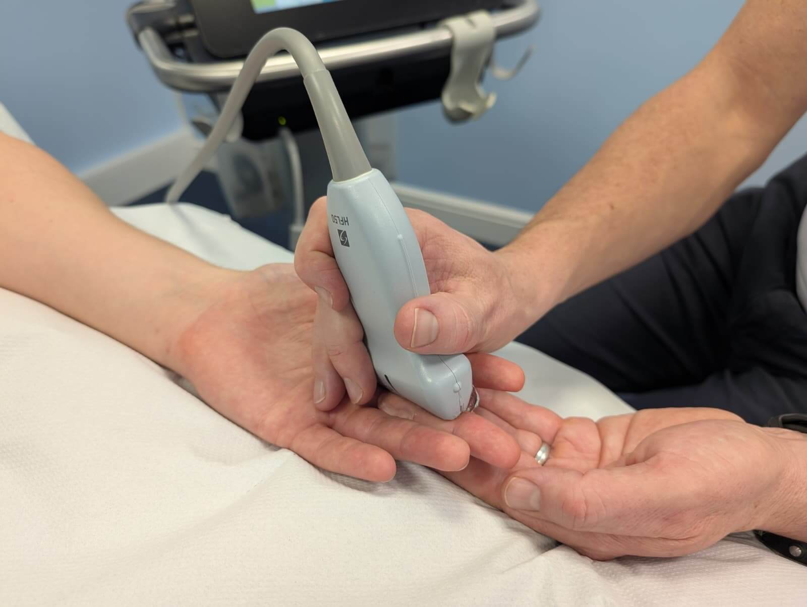Physio Common Conditions Trigger finger